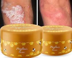 Официальный сайт производителя продукции «медовый спас». Krem Medovyj Spas Ot Psoriaza Cena 5490 Tg Kupit V Almaty Satu Kz Id 60907381