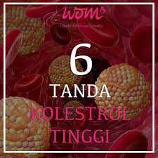 Penderita kolesterol tinggi lebih sering mengalami gangguan penglihatan dan meskipun kondisi ini juga sering terjadi pada orang lanjut usia. 7 6 Tanda Kolestrol Tinggi Ideas Tanda Online Magazine Women Online