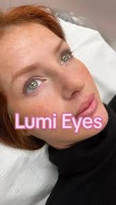 Lumi Eyes After 3 Sessions