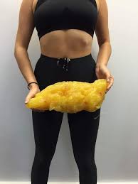 How Accurate Are Those Photos Showing This Is What 5lbs Of Fat Looks Like I M Down 4kg And Barely Look Any Different I Don T Believe I Lost That Much Fat R Loseit