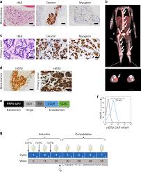 On average, cats are able to live for up to two years with feline bone cancer. Tumor Response And Endogenous Immune Reactivity After Administration Of Her2 Car T Cells In A Child With Metastatic Rhabdomyosarcoma Nature Communications
