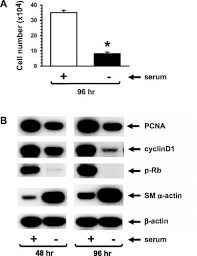 Expression of conventional and novel glucose transporters, GLUT1, -9, -10,  and -12, in vascular smooth muscle cells