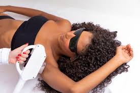 Depilação a laser para pele negra: indicações e riscos - Tua Saúde