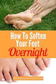 How To Soften Feet Overnight The Ultimate Guide Today