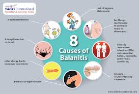 If so, how? answered by dr. Men Can Get Yeast Pathologists Lancet Kenya Plk Facebook