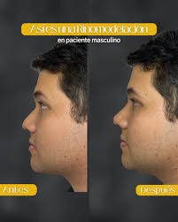 Dra Karen Quevedo. Armonización facial y corporal (@drakarenquevedo) •  Instagram photos and videos