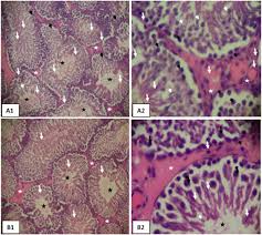 Image result for Fadogia cienkowskii