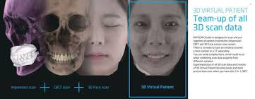 Full Guided Dental Implants Surgery & Digital Dentures Services in  Kingston, NY