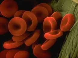 Let's look at some of the most common types of rheumatic diseases and the underlying causes. Malattia Autoimmune Medicinalive
