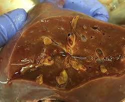 I'd lost my appetite and was. Liver Fluke Diseases Solutions Farm Health First