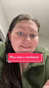 Everything You Need to Know About Plus Size C-Sections