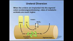 Simplified this is where the doctor look at normal anion acidosis is loss of the bicarbonate from the body. Normal Anion Gap Metabolic Acidosis Abg Interpretation Lesson 9 Youtube