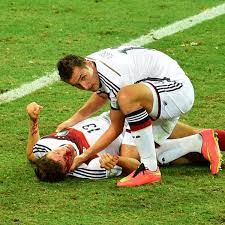 Alles gute zum geburtstag, miroslav #klose! Wm Thomas Muller Blutuberstromt Verletzung Bei Deutschland Ghana Fc Bayern