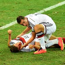 The meaning of the curves is the same as in fig. Wm Thomas Muller Blutuberstromt Verletzung Bei Deutschland Ghana Fc Bayern