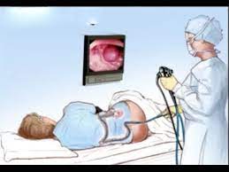 Das flexible schlauchartige untersuchungsinstrument wird in den after. Darmspiegelung Keine Angst Vor Der Coloskopie Youtube