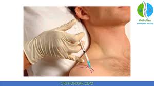 Image result for Biceps Tendon Injection