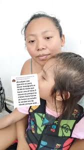 Radiografía Del Cráneo De Un Niño