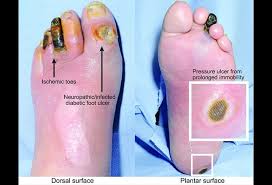 We did not find results for: 19 Common Foot Disorders