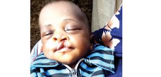 Gbajabiamila pays Katsina three-year-old girl's medical bills