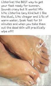 Plantar fasciitis | go ask alice! Remove Dead Skin From Feet In 10 Minutes This Works I M Going To Do It At Least Once A Week Diy Pedicure Beauty Skin Health And Beauty Tips
