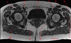 Typical anatomical locations for skeletal muscle measurements using ct are the thigh, proximal femur, and trunk. Mri Of The Hip Detailed Anatomy W Radiology