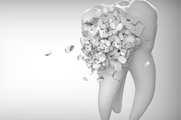 Mercury-Free Dentistry in North York | Mercury-Free Dentistry Near You