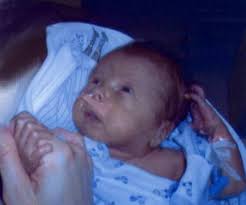 Bradley Bohn Obituary