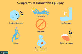 Discover 1 eplipsy design on dribbble. Intractable Epilepsy Symptoms Causes Diagnosis And Treatment