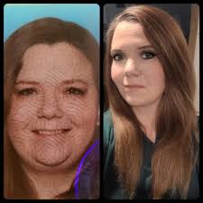 Weight loss and health improvement through lifestyle changes