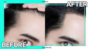 A receding hairline first starts at the temples (the area between the eye and the ear at the side of the head). Instant Fix For Receding Hairline Thinning Hair Hair Makeup James Welsh Youtube