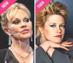 Melanie griffith is telling all! Melanie Griffith Plastic Surgery Before After Plastic Surgery Before And After