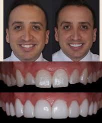 32 Bellevue Dentist Dr. Andrew Keller ideas