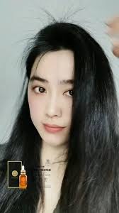 CHÍNH HÃNG ] SERUM MỌC DÀI TÓC KING VENUS Serum Mọc Tóc 1 Chai Tặng 1 Lược  Serum Mọc Tóc Cho Nam Và Nữ Serum Mọc Tóc Hiệu Quả Nhanh