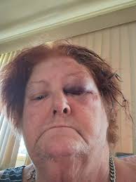 Hurricane Beryl hits Cayman Islands and other areas