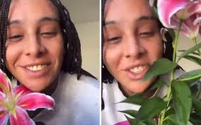 Ex-BBB Marcus Vinicius faz novo transplante capilar após trauma