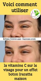 Voici Comment Utiliser La Vitamine C Sur Le Visage Pour Un Effet Botox Recette Maison En 2020 Vitamine E Soins Beaute Botox