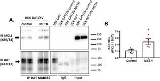 Corrections & clarifications below.o you can. Clustered Kv2 1 Decreases Dopamine Transporter Activity And Internalization Journal Of Biological Chemistry