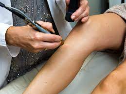 We are committed to ensuring that you receive the highest quality, at the lowest. Laser Hair Removal Burns Prevention Treatment And More