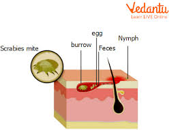 Image result for Sarcoptes scabiei life cycle