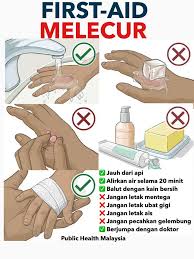 Caranya, letakkan tiga sudu kecil gula putih ke dalam mangkuk bersih, masukkan air kencing anda ke dalam mangkuk berisi gula dan biarkan ia selama lima ke 10 minit. Jangan Letak Ubat Gigi Kalau Anggota Badan Melecur Ini Cara Patut Buat Elak Jangkitan Kuman Vanilla Kismis