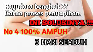 Bagaimana lecithin mengatasi bengkak susu. Cara Mengobati Susu Asi Yg Bengkak Karena Menyapih Info Lif Co Id