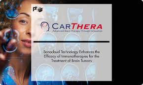 CARTHERA'S SonoCloud technology enhances the efficacy of immunotherapies  for the treatment of brain tumors