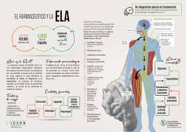 No existen exámenes específicos que permitan diagnosticar la ela, sin embargo, una combinación de exámenes para identificar los síntomas comunes puede ser de utilidad para delimitar el diagnóstico de la ela. Ela Esclerosis Lateral Amiotrofica Farmacia Escriva Esclerosis Lateral Esclerosis Lateral Amiotrofica Esclerosis