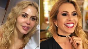 Antes da fama, joelma passou a adolescência com os fios morenos e ficou loira durante toda a carreira musical. Joelma Mostra Antes E Depois Da Harmonizacao Facial Famosos Extra Online