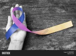 When symptoms of bladder cancer do occur, they include: Bladder Cancer Image Photo Free Trial Bigstock