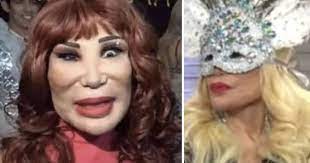 We did not find results for: Lyn May Mostro Su Nuevo Rostro Tras Operarse Y Quedo Mejor Que Alejandra Guzman