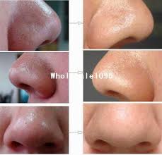 Pin By Patricia Guel Pinon On Make Up Deep Blackheads Beauty Hacks Health And Beauty Tips