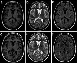 Simply speaking, this modality measures how quickly the tissue becomes magnetized. Figure 2 From Synthetic Mri Of The Brain In A Clinical Setting Semantic Scholar