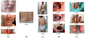 Diagnosis, Management, and Prognostic Assessment of Chronic Disease