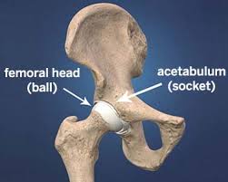 Pain in your hip that heightens with activity and lessens with rest. Xlz1n02a10qyvm